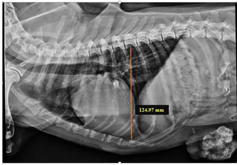Fig. 3: Skiagram showing measurement of chest depth on right lateral view for assessment of the cardiothoracic ratio
