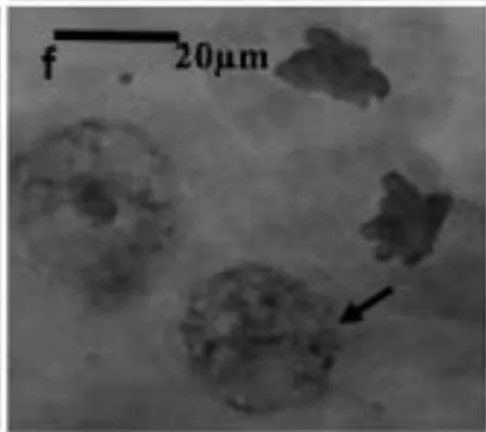 Figure 2: Various chromosome deformities in Z. variegatus on treatment with aqueous extracts of C. melo