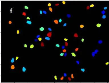Figure 1a: Original image of breast cancer tissue Figure 1b: Figure 1a converted to greyscale Figure 1c: Figure 1b with inverted intensities Figure 1d & e: Initial identification of nuclei Figure 1f: Remaining objects after filtering for subsequent analysis
