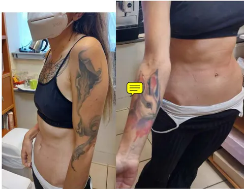 Figures 1-4: Images from our patient's extensive tattoos.