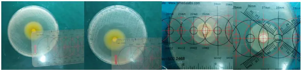 Fig.1: Zone of inhibition measured for TAP (saline), TAP (Chlorhexidine), Calcium hydroxide (saline) and Calcium hydroxide (Chlorhexidine)