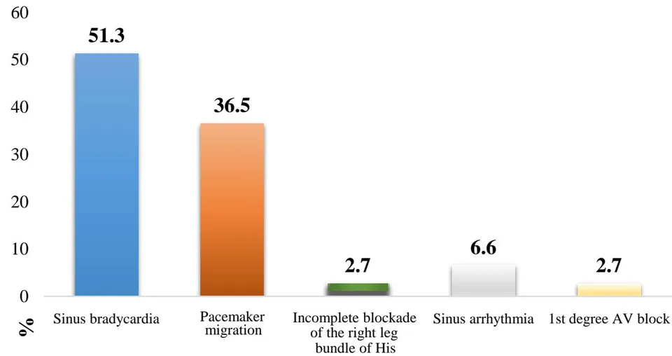 Figure 1: Distribution of "benign" rhythm disturbances.