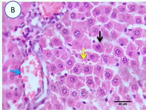 Fig. 1: Photo-micrograph from liver, control group, showing normal hepatic parenchyma with preserved lobular pattern, central veins (blue arrow), Sinusoids and hepatic cords (black arrow). Scale bars 120, 40 um