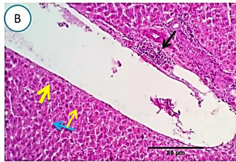 Fig. 2: Photomicrograph of liver (Group.G) showing normal hepatic parenchyma(blue arrows), vascular dilatation(yellow arrows)and mild portal round cells aggregation(black arrows). Scale bars 60, 80 um