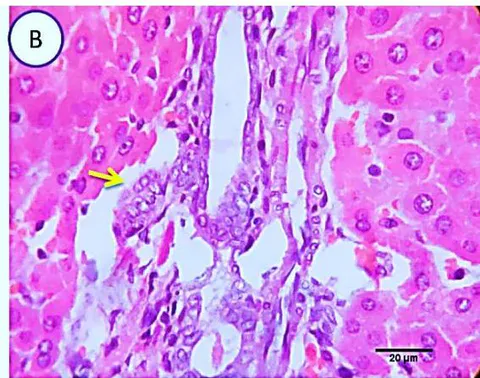Fig. 3: Photo-micrograph from liver, group (2), showing, portal biliary proliferation (yellow arrow), congestions of portal blood vessels (blue arrow) and round cell infiltration beside degenerative changes in a few hepatocytes. Scale bars 120, 20 um.