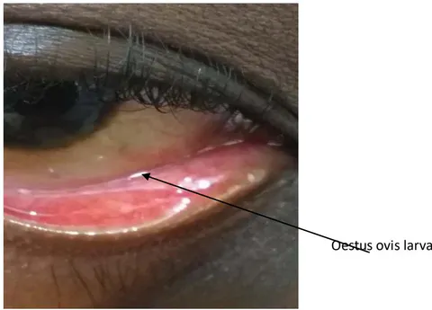 Figure 3: Macroscopic appearance of the first stage L1 Oestrusovis larva.