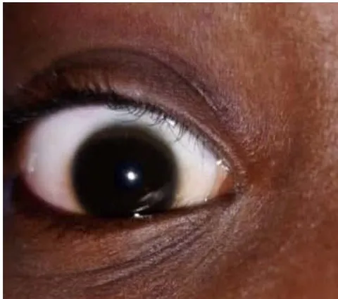 Figure 2: Appearance on the fifteenth day (D15) of the treatment.