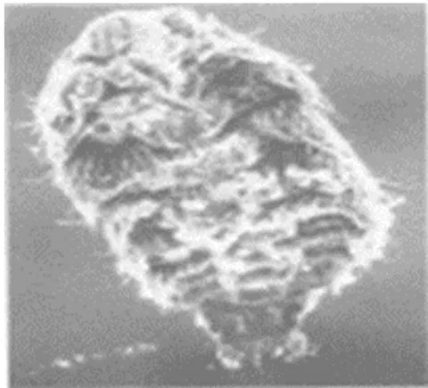 Fig. 4: Larva of oestrus ovis: ventral side [electron microscopy image (x120) Showing the cat's claw hooks curved and arranged in 2 groups] Source: Steven JD et al Br J Ophthalmol 1991(75) [9]