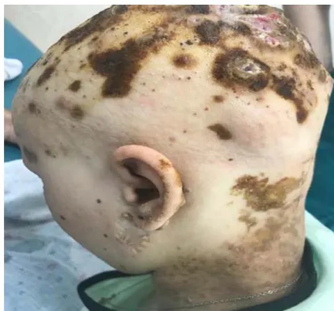 Fig. 4: Before surgery: rear view and lateral view.