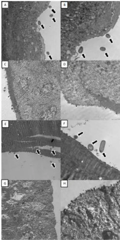 Fig. 3: Ultrastructure of mouse vagina i.va. inoculated with phytobiotics, lactobacilli or phytocompounds analysed by transmission electron microscopy. A:L. salivarius CRL1328+Hamamelis (2500X); B: L. salivarius CRL1328+Hamamelis (4000X); C: Hamamelis (1200X); D: Hamamelis (4000X); E: L. salivarius CRL1328 (1200X); F: L. salivarius CRL1328 (4000X); G: Peptone-water Control Mice Group (800X); H: peptone-water Control Mice Group (4000X). Bacteria or bacilli close or in contact with the epithelial vaginal cells are indicated with black arrows.