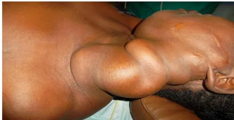 Figure 1: Topography of Lesions