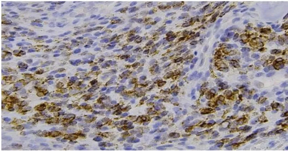 Figure 3: Histological slide