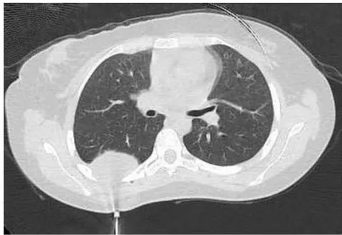 Figure 1: Tomographic scout prior to surgery