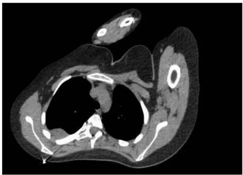 Figure 2: Tomographic scout prior to surgery