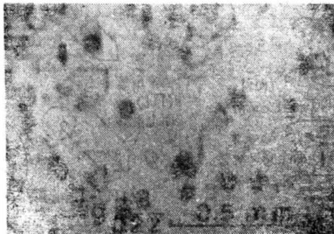 Fig. 21: The circular stacking fault along the vortex defect and the semi-dislocation ring B, (111) wafer on the (111) plane perpendicular to the surface intersection mark