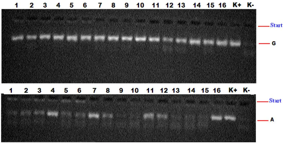Fig. 1: Electropherogram for TNFα gene polymorphism detection.