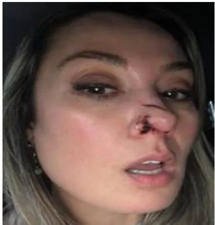 Figure 3: November 2019 - Eight years after the accident. After treatment