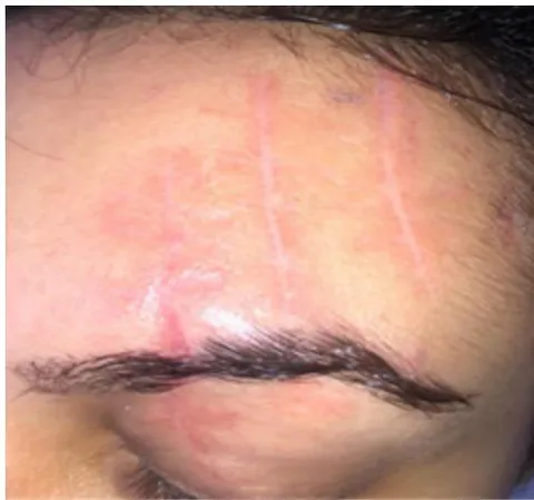Figure 8: Mar/24/2020 - Aftertreatment Figure 9: Aug/17/2020 - After treatment