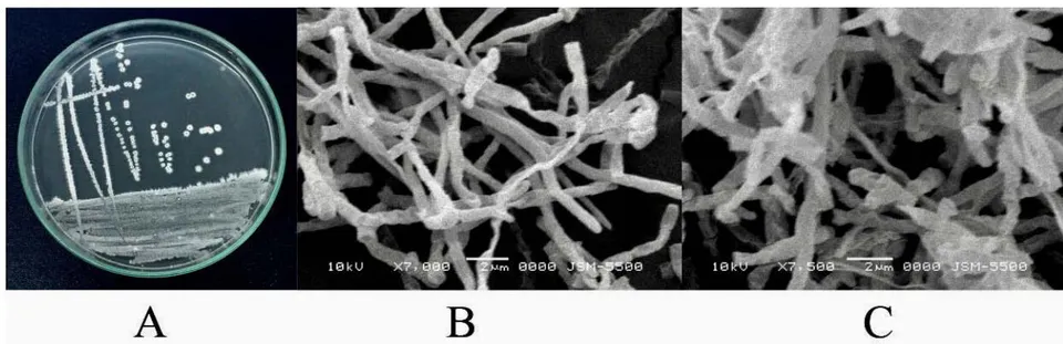 Figure 11: Colonies of Streptomyces africanus LONGHOA 4.2 strain (A) shapes and spores of Streptomyces africanus LONGHOA 4.2 strain under SEM (B and C)