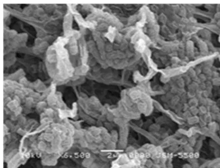Figure 10: Colonies of Streptomyces parvulus ANTHOIDONG 3.1 strain (A) shapes and spores of Streptomyces parvulus ANTHOIDONG 3.1 strain under SEM (B and C)