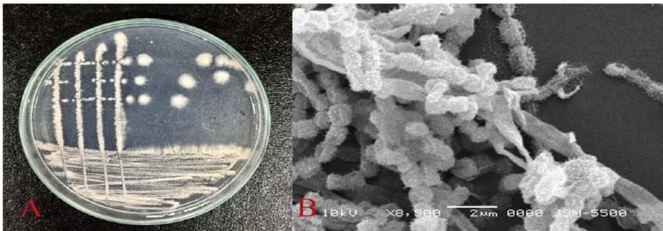 Figure 5: Colonies of Streptomycescelluloflavus ANTHOIDONG 4.1 strain(A) and cells and spores S.celluloflavus ANTHOIDONG 4.1 strainunder SEM (B)