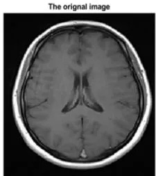 Fig. 13: ICA FWD filter: The original Pics to the left, the noised pics in the middle, and the denoised pics to the right The original image