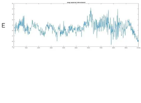 Fig. 1: FWD & Sparse FWD Filters (EEG signal 1): A original signal, B noised signal, C noised signal (original signal in blue and noise in red), D denoised signal (FWD), E denoised signal (Sparse FWD)