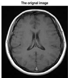 Fig. 10: ICA Pow3 filter: The original Pics to the left, the noised pics in the middle, and the denoised pics to the right
