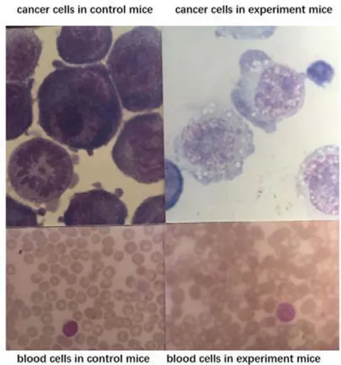 Fig. 2: MRT kill cancer cells but no effect to blood cells