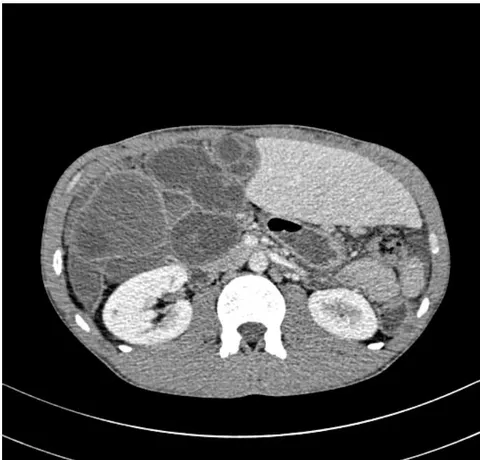 Figure 1B: