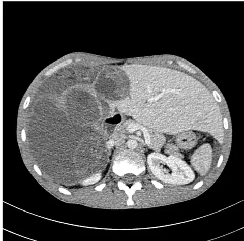 Figure 1A:
