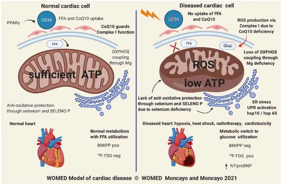 Figure 14: The 2021 WOMED model of cardiac disease