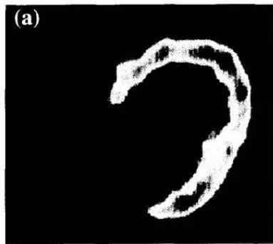 Figure 4: Taken from Umezawa (143). The Figure is used on the basis of Creative Common CC-BY-NC. Umezawa R, Takase K, Jingu K, Takanami K, Ota H, Kaneta T, et al. Evaluation of Radiation-Induced Myocardial Damage Using Iodine-123 B-Methyl-Iodophenyl Pentadecanoic Acid Scintigraphy. J Radiat Res (2013) 54(5): 880-9. Epub 2013/02/16. doi: https://doi.org/10.1093/jrr/rrt011