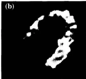 Fig 3. FDG-PET in the fasting state before and after 3 months of carvedilol therapy. (a) FDG uptake was enhanced throughout the left ventricle and (b) alleviated by carvedilol therapy. Figure 6: Taken from Hirooka et al. (151). Hirooka K, Yasumura Y, Ishida Y, Komamura K, Hanatani A, Nakatani S, et al. Improvement in Cardiac Function and Free Fatty Acid Metabolism in a Case of Dilated Cardiomyopathy with Cd36 Deficiency. Jpn Circ J (2000) 64(9): 731-5. doi: https://doi.org/10.1253/jcj.64.731. License granted