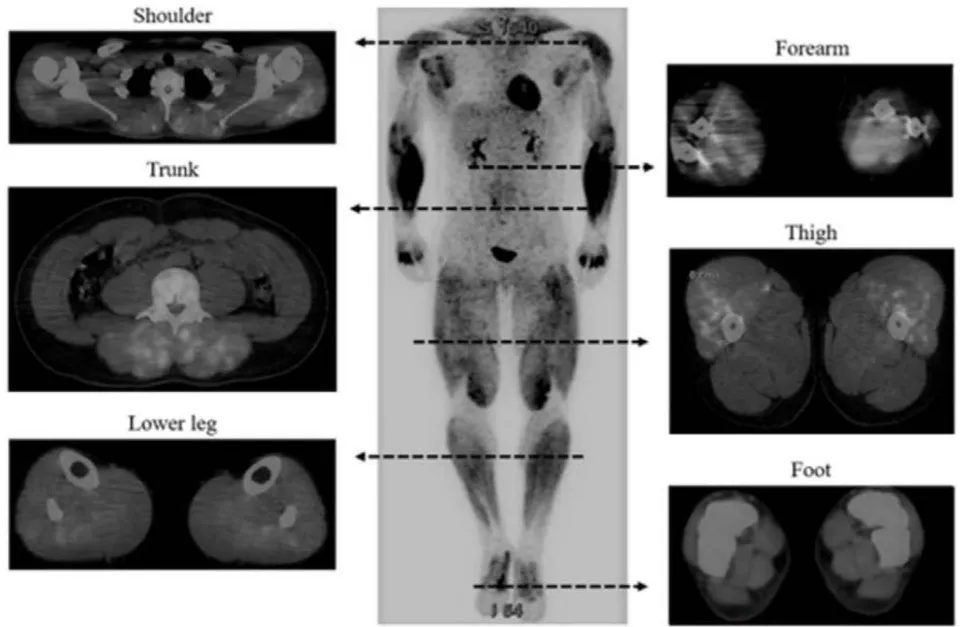 Figure 10: Taken from Yoshimizu R. Whole Body Muscle Activity During Weightlifting Exercise Evaluated by Positron Emission Tomography (2022). Available from: https://www.researchsquare.com/article/rs-612816/v2. License: CC BY 4.0 Figure 2