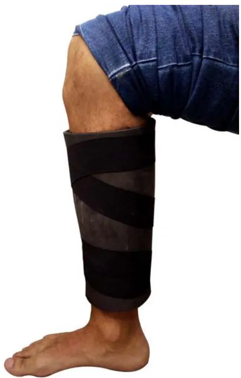 Figure 3: Application of the LED mat directly on the skin involving the whole leg bilaterally.