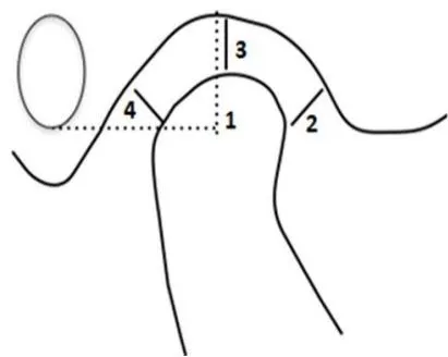 Figure 1: Illustration of the measurements in the sagittal section