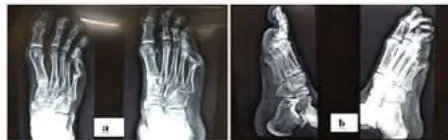 Figure 2: Pre-operative Radiographs