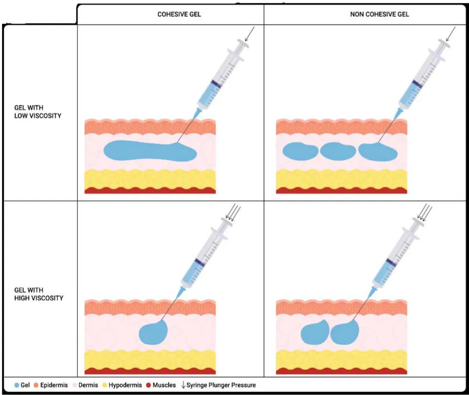 Figure 6: Schematic representation of the cohesion and viscosity of an HA gel reveals a pivotal correlation. The gel's fluidity is greatly enhanced by its low viscosity and low cohesiveness, which results in a lack of unity. On the other hand, a gel that has low viscosity but high cohesiveness maintains its structural integrity while still remaining fluid. This balance also influences the level of force necessary to extrude the gel through a syringe and needle. When examining a filler with high viscosity and strong cohesiveness, it manifests as a denser and more cohesive gel, demanding greater force for extrusion. Conversely, in the absence of cohesiveness, the gel fails to maintain its unity after being injected into the dermis. In summary, the delicate balance between viscosity and cohesiveness significantly influences both the physical properties of the gel and its performance during injection, shaping the final outcome in dermal applications.