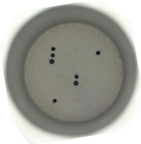 Figure 1: This image shows a negative result and the controls to monitor. B: hybridization control indicates that the hybridization process worked correctly. C: endogenous amplification control (β-globin) indicates that the amplification worked correctly, and the clinical sample contains human DNA.