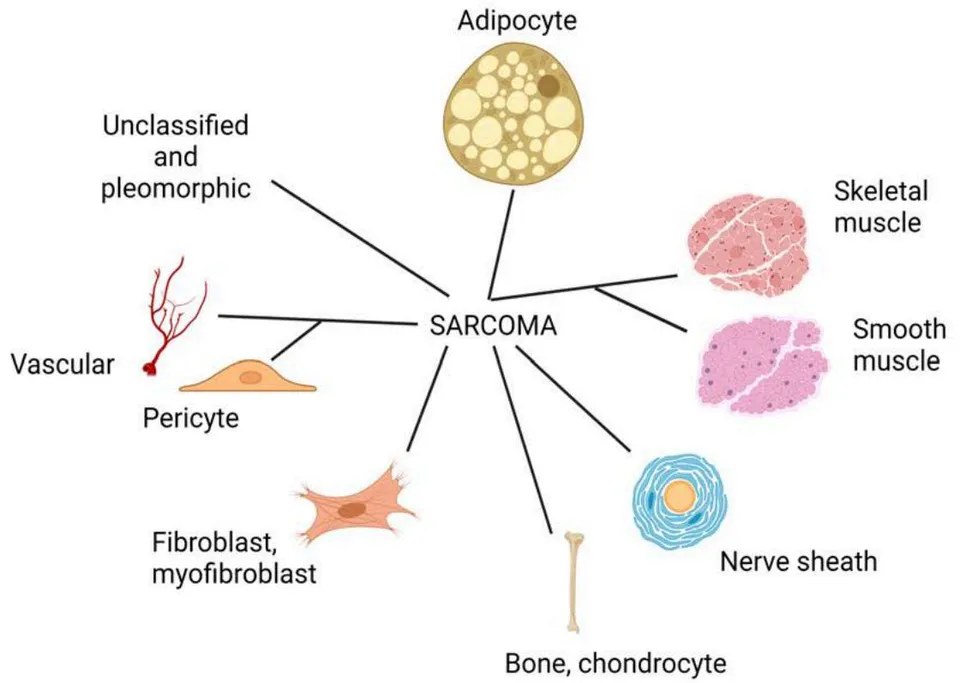 Figure 1: The Taxonomy of Soft Tissue Sarcoma. Sarcomas are classified according to pathologically defined tissue differentiation states. Liposarcomas are the adipocytic tumors