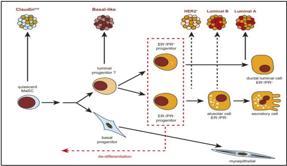 Figure 1: Schematic model of the relationships between cells of the breast epithelial hierarchy and breast tumour subtypes. Luminal progenitors also show marked de differentiation during oncogenesis. [2].
