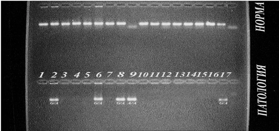 Figure 1: The specificity and the numbers of amplified fragments were checked by electrophoresis in 4% agarose gel.