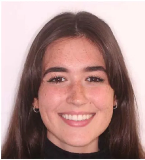 Fig. 6: Ideal Smile should show sufficient discovery at rest