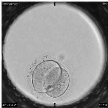 Figure 4: Reverse cleavage of 2-4-2 embryos, magnification 200X.