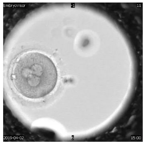Figure 2: Human embryo of the 1st day of development at the 3PN2PB stage, magnification 200X.