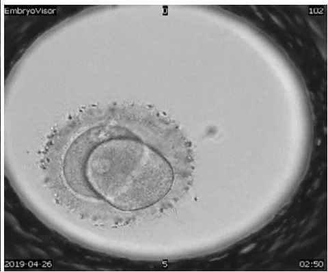 Figure 3: Reverse crushing of human embryos 3-2, magnification 200X.