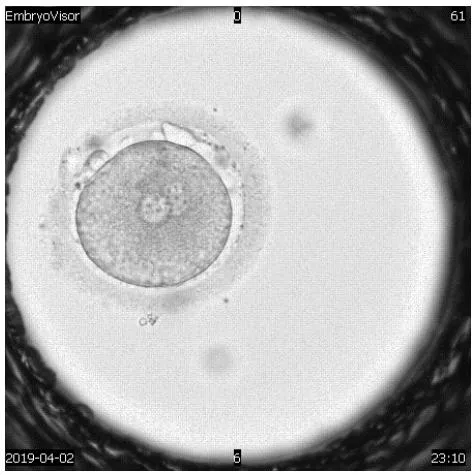 Figure 1: Human embryo of the 1st day of development at the 2PN2PB stage (zygote), magnification 200X.