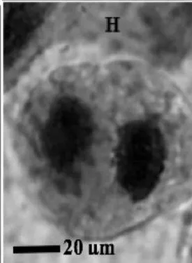Figure 2: Mitotic and chromosomal aberrations (CA) (arrowed) induced in Allium cepa root tips by aqueous extracts of the roots of C. melo. A and B=Anaphase laggard; C= Disoriented Anaphase; D= Nuclear vacuoles; E=Anaphase Bridge; F=Sticky chromosomes; G=Mature cell showing puff; H=binucleated cell