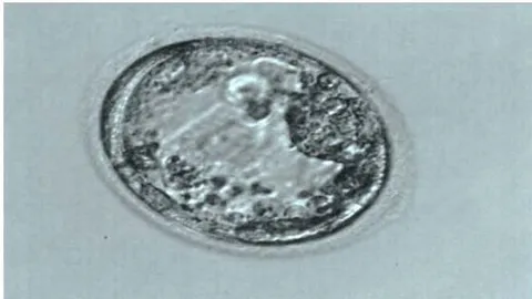 Fig. 2: Human embryo 5 days of development, human blastocyst stage 2 hours after thawing. Boost: x200.